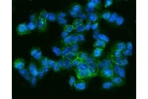 IF analysis of CD9 using anti-CD9 antibody (ABIN4886531). (CD9 抗体  (AA 110-193))