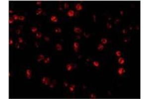 Immunofluorescence (IF) image for anti-Beclin 1, Autophagy Related (BECN1) (C-Term) antibody (ABIN497977)