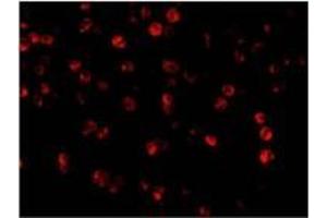 AP20057PU-N Beclin-1 antibody staining of A431 cells by Immunofluorescence at 2 μg/ml. (Beclin 1 抗体  (C-Term))