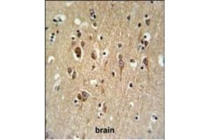 FA2H Antibody (Center) (ABIN650994 and ABIN2840028) IHC analysis in formalin fixed and paraffin embedded brain tissue followed by peroxidase conjugation of the secondary antibody and DAB staining. (FA2H 抗体  (AA 121-148))