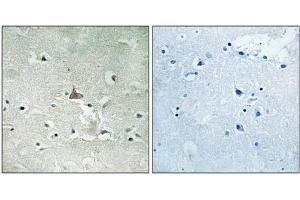Immunohistochemical analysis of paraffin-embedded human brain tissue using Trk B (Phospho-Tyr706/Tyr707) antibody (left)or the same antibody preincubated with blocking peptide (right).