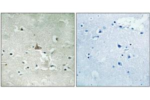 Immunohistochemical analysis of paraffin-embedded human brain tissue using Trk B (Phospho-Tyr706/Tyr707) antibody (left)or the same antibody preincubated with blocking peptide (right). (TRKB 抗体  (pTyr706, pTyr707))