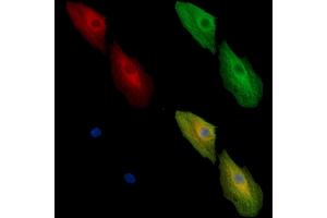 ABIN7096990 and ABIN7101057 staining  cells by IF/ICC. (ADSSL1 抗体)