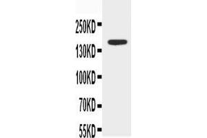 Anti-ABCB4 antibody, Western blotting WB: MCF-7 Cell Lysate (ABCB4 抗体  (N-Term))