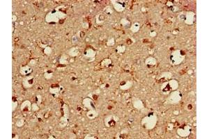 Immunohistochemistry of paraffin-embedded human brain tissue using ABIN7145729 at dilution of 1:100 (BAIAP2 抗体  (AA 123-368))