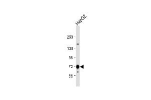 Anti-CPT2 Antibody (C21) at 1:1000 dilution + HepG2 whole cell lysate Lysates/proteins at 20 μg per lane.