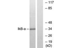 Western blot analysis of extracts from MCF7 cells, treated with TNF-alpha, using IkappaB-alpha (Ab-32/36) Antibody. (NFKBIA 抗体  (AA 15-64))