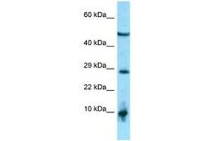 ATRAID antibody  (AA 182-231)