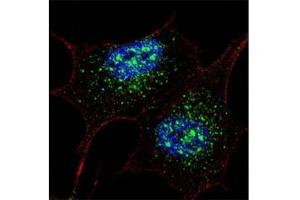 Fluorescent confocal image of SY5Y cells stained with NANOG antibody at 1:200. (Nanog 抗体  (AA 267-292))