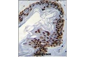 IFI35 Antibody (N-term R30) (ABIN655077 and ABIN2844709) immunohistochemistry analysis in formalin fixed and paraffin embedded human skin tissue followed by peroxidase conjugation of the secondary antibody and DAB staining. (IFI35 抗体  (N-Term))