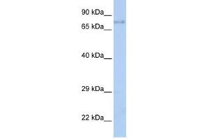 IGF1R antibody (70R-10422) used at 0. (IGF1R 抗体  (Middle Region))