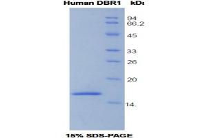 SDS-PAGE analysis of Human DBR1 Protein. (DBR1 蛋白)