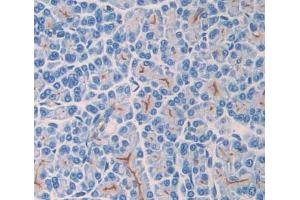 Used in DAB staining on fromalin fixed paraffin- embedded pancreas tissue (TLR3 抗体  (AA 381-699))