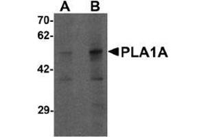 Western blot analysis of PLA1A in human kidney tissue lysate with PLA1A antibody at (A) 1 and (B) 2 ug/mL. (PLA1A 抗体  (C-Term))