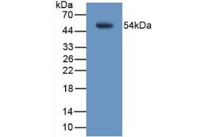 Western Blot; Sample: Recombinant TMEM27, Mouse. (TMEM27 抗体  (AA 12-222))