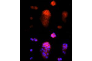 Immunofluorescence analysis of MCF7 cells using AAMP Rabbit mAb (ABIN7265584) at dilution of 1:25 (40x lens). (AAMP 抗体)