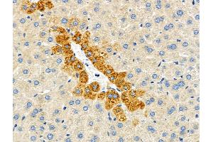 ABIN6264412 and ABIN6276690 at 1/100 staining Mouse liver tissue by IHC-P.