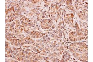 IHC-P Image Immunohistochemical analysis of paraffin-embedded A549 xenograft, using NAT2, antibody at 1:100 dilution. (NAT2 抗体)