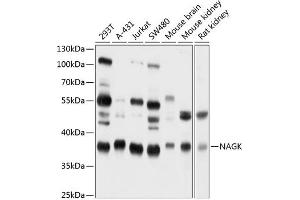 Western blot analysis of extracts of various cell lines, using NAGK antibody (ABIN6130569, ABIN6144344, ABIN6144345 and ABIN6224883) at 1:1000 dilution. (NAGK 抗体  (AA 50-210))