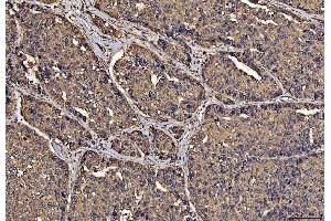 IHC analysis of PDIA6 using anti-PDIA6 antibody (ABIN7600554). (PDIA6 抗体  (AA 20-440))