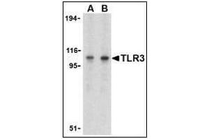 Western blot analysis of TLR3 in Daudi cell lysate with TLR3 antibody at (A) 1 and (B) 2 µg/ml. (TLR3 抗体  (C-Term))