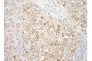 Immunohistochemistry (IHC) image for anti-Tuftelin Interacting Protein 11 (TFIP11) (AA 1-50) antibody (ABIN7448831) (TFIP11 抗体  (AA 1-50))