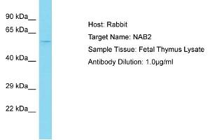 Host: Rabbit Target Name: NAB2 Sample Tissue: Human Fetal Thymus Antibody Dilution: 1ug/ml (NAB2 抗体  (N-Term))
