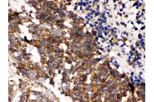 Immunohistochemistry (IHC) image for anti-Polo-Like Kinase 1 (PLK1) (AA 86-430) antibody (ABIN3043354)
