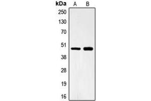 Western blot analysis of FOXB2 expression in Lovo (A), HeLa (B) whole cell lysates. (FOXB2 抗体  (Center))