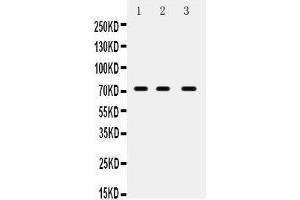Anti- ABCG5 Picoband antibody, Western blotting All lanes: Anti ABCG5  at 0.