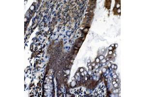 IHC analysis of CDC27 using anti-CDC27 antibody (ABIN7602163).