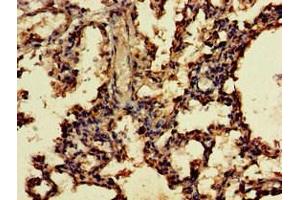 Immunohistochemistry of paraffin-embedded human lung tissue using ABIN7166249 at dilution of 1:100 (UNC13D 抗体  (AA 7-172))