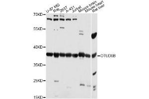 Western blot analysis of extracts of various cell lines, using OTUD6B antibody (ABIN6293808) at 1:3000 dilution. (OTUD6B 抗体)