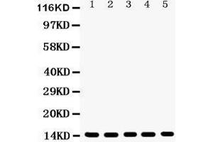 Anti- Profilin1 Picoband antibody, Western blotting All lanes: Anti Profilin1  at 0. (PFN1 抗体  (C-Term))
