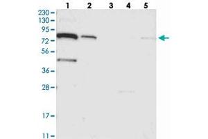Western blot analysis of Lane 1: RT-4, Lane 2: U-251 MG, Lane 3: Human Plasma, Lane 4: Liver, Lane 5: Tonsil with SLC6A12 polyclonal antibody . (SLC6A12 抗体)