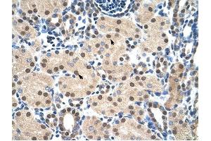 MYB antibody was used for immunohistochemistry at a concentration of 4-8 ug/ml to stain Epithelial cells of renal tubule (arrows) in Human Kidney.