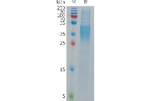 SDS-PAGE (SDS) image for Fc Fragment of IgG, Low Affinity IIIb, Receptor (CD16b) (FCGR3B) (AA 17-199) protein (His tag) (ABIN7491483)