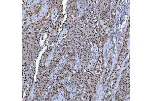 IHC analysis of TRMT6 using anti-TRMT6 antibody (ABIN7602138). (TRMT6 抗体  (AA 6-489))