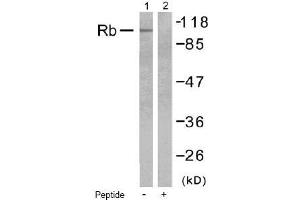 Image no. 1 for anti-Retinoblastoma 1 (RB1) (Ser795) antibody (ABIN197280) (Retinoblastoma 1 抗体  (Ser795))