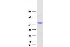 Western Blotting (WB) image for SLP Adaptor and CSK Interacting Membrane Protein (SCIMP) protein (Myc-DYKDDDDK Tag) (ABIN2714081)