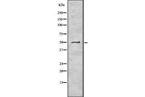 Western blot analysis of PNLIP using Jurkat whole cell lysates (PNLIP 抗体  (C-Term))