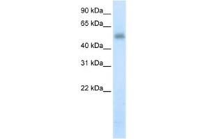 WB Suggested Anti-METTL3 Antibody Titration:  5. (METTL3 抗体  (N-Term))