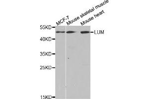 Western blot analysis of extracts of various cell lines, using LUM antibody (ABIN5973088) at 1/1000 dilution. (LTBR 抗体)