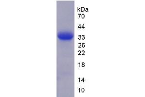 SDS-PAGE of Protein Standard from the Kit  (Highly purified E. (Granulin ELISA 试剂盒)