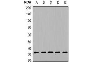 Western blot analysis of DGUOK expression in HepG2 (A), mouse heart (B), mouse kidney (C), rat liver (D), rat brain (E) whole cell lysates. (Deoxyguanosine Kinase 抗体)