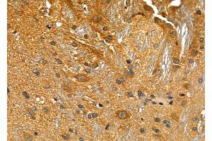 ABIN6258175 and ABIN6276034 at 1/100 staining Rat brain tissue by IHC-P.
