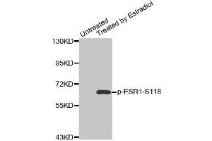 Western blot analysis of extracts from MDA cells using Phospho-ESR1-S118 antibody (ABIN2987431). (Estrogen Receptor alpha 抗体  (pSer118))