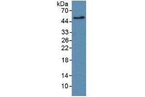 WB of Protein Standard: different control antibodies  against Highly purified E. (ErbB2/Her2 ELISA 试剂盒)