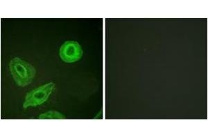 Immunofluorescence analysis of HeLa cells, using HER3 (Phospho-Tyr1289) Antibody. (ERBB3 抗体  (pTyr1289))