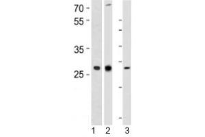 Western blot analysis of 1) human CEM, 2) rat PC-12, and 3) mouse spleen tissue lysate using LIF antibody at 1:1000.
